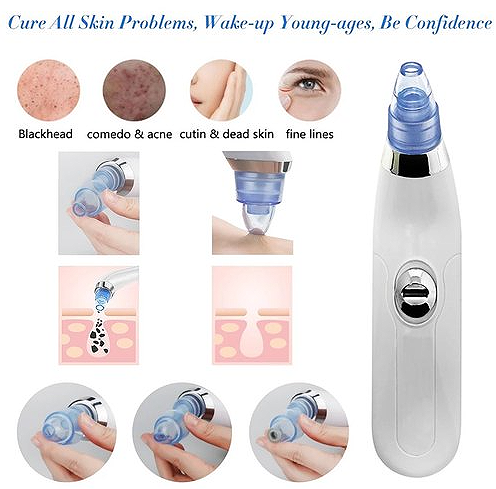 Aparat za čišćenje pora i mitisera - Dermasuction