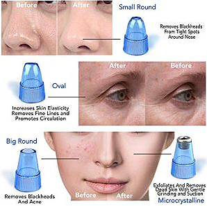 Aparat za čišćenje pora i mitisera - Dermasuction